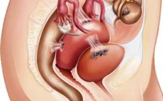 Какие травы лечат эндометриоз наиболее эффективно? Узнайте полезные советы