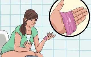 Может ли быть молочница без зуда? Важные аспекты и советы