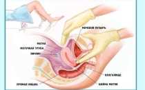 Гинекологические зеркала: размеры, назначение. Инструменты врача-гинеколога