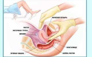 Гинекологические зеркала: размеры, назначение. Инструменты врача-гинеколога