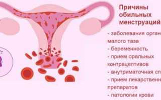 Чем можно остановить обильные месячные в домашних условиях безопасно и эффективно