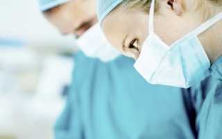 Когда можно беременеть после удаления миомы матки? Важные рекомендации и советы