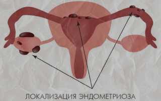 Что делать при очень обильных месячных со сгустками: советы и рекомендации