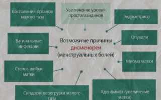 Что делать, если при месячных сильно болит живот: советы и рекомендации