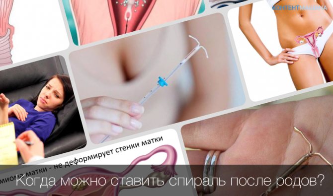 Когда можно ставить спираль после родов