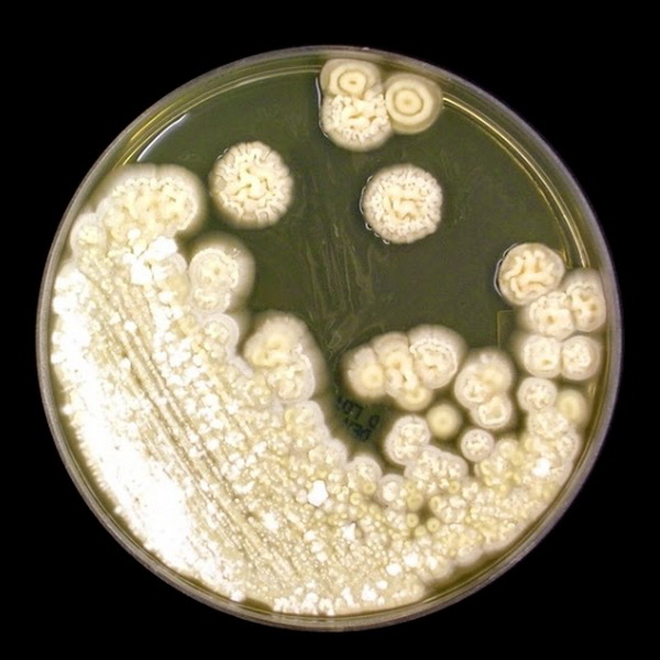 Мазок на флору покажет молочницу