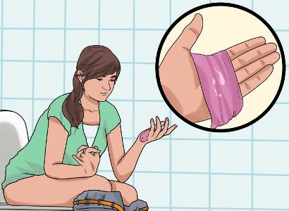 молочница без выделений но с зудом