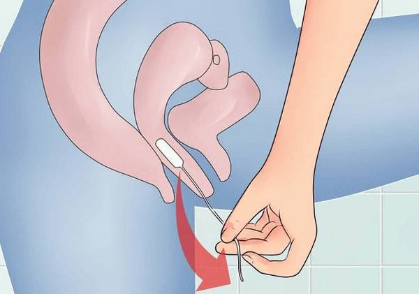 вывести тампон