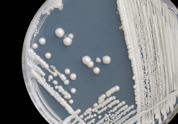 Анализы на кандидоз