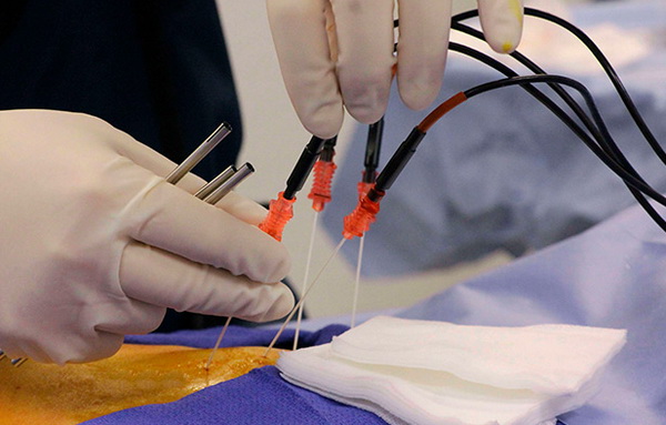 Современные методы лечения