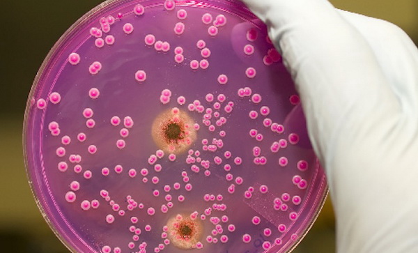 Анализы в лаборатории