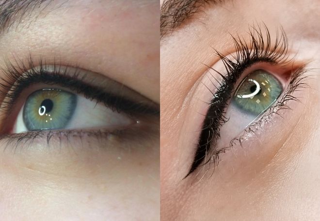 широкая межресничка широкая межресничка