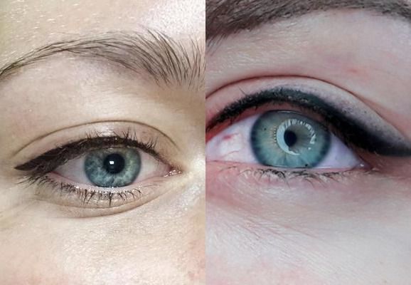 нижняя межресничка нижняя межресничка