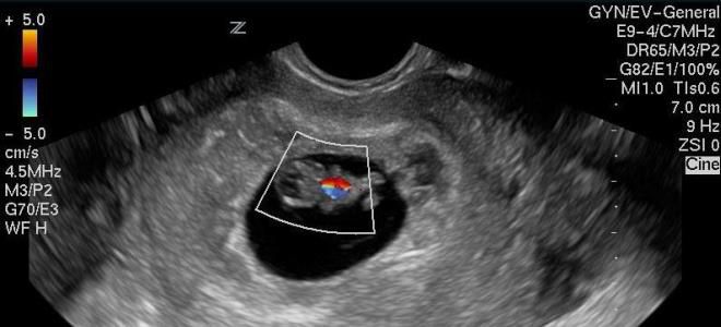 8 недель беременности 8 недель беременности