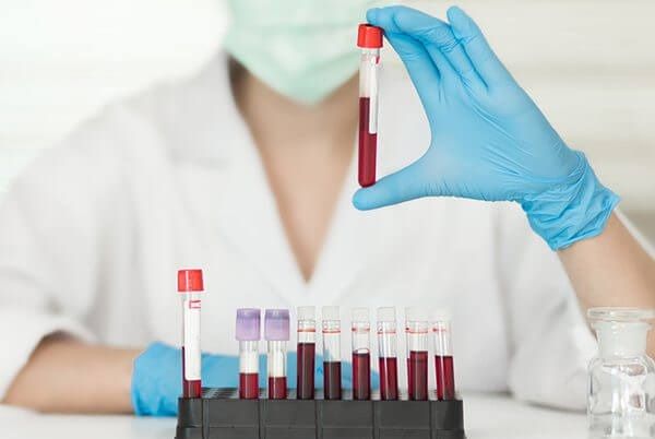 биохимия крови норма биохимия крови норма