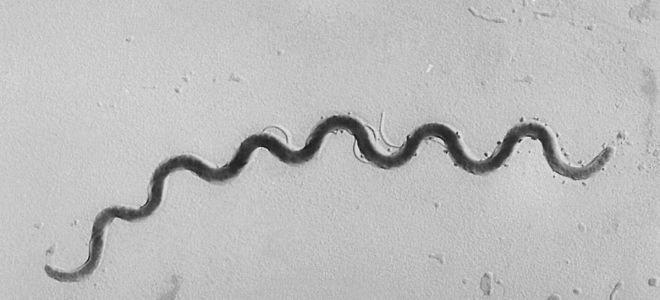 бледная трепонема вызывает бледная трепонема вызывает