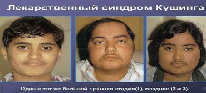 фото1 диагностика заболеваний гипофиза