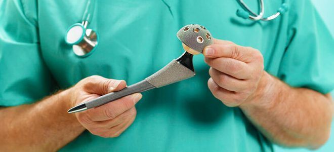 Эндопротезы тазобедренного сустава виды Эндопротезы тазобедренного сустава виды