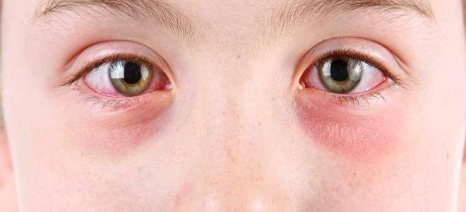 фото1 глазные капли зодак