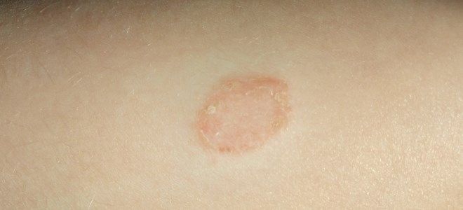 кандидерм состав кандидерм состав