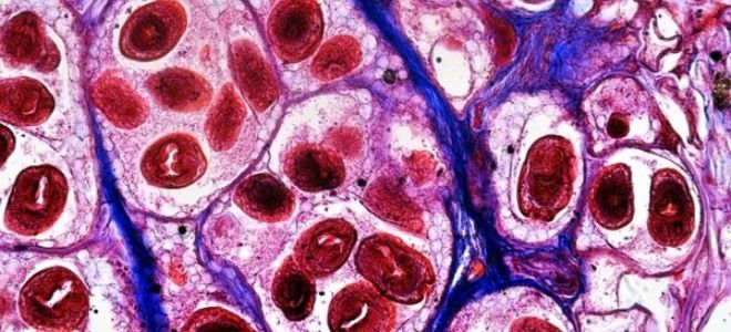 киста в печени причины возникновения и последствия киста в печени причины возникновения и последствия