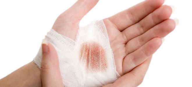 мазь для заживления ран на коже мазь для заживления ран на коже