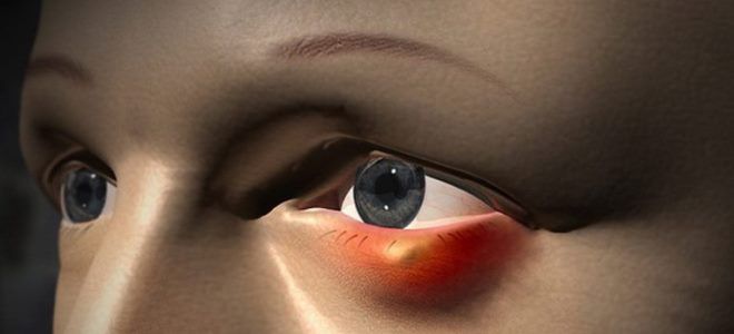 наружный ячмень наружный ячмень