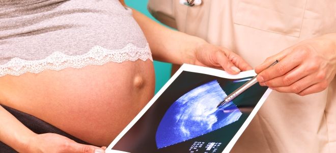 объем околоплодных вод объем околоплодных вод