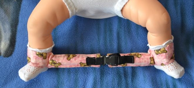 шины виленского для детей шины виленского для детей