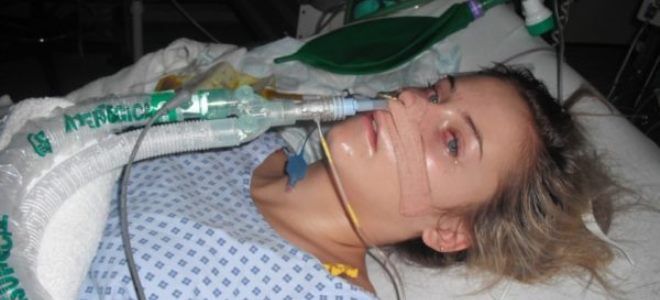 синдром гийена барре признаки синдром гийена барре признаки