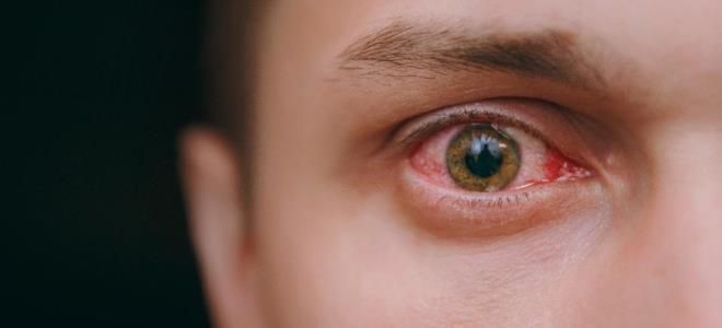 фото1 тобрекс что за капли