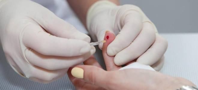 тромбоциты в крови тромбоциты в крови