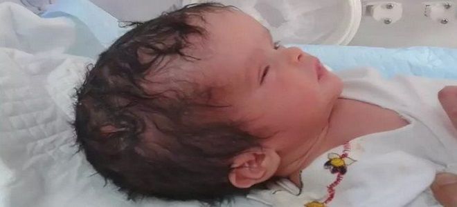 водянка мозга причины водянка мозга причины