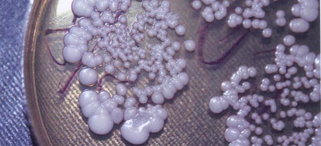 выделения при молочнице выделения при молочнице