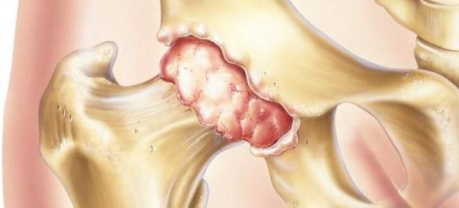 амелотекс для суставов амелотекс для суставов