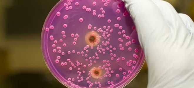 бактериологическое исследование кала бактериологическое исследование кала