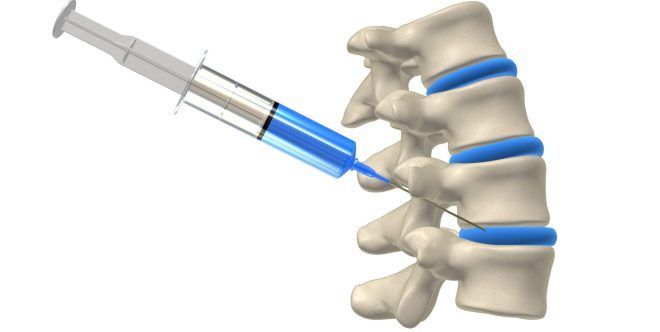 блокады при остеохондрозе позвоночника блокады при остеохондрозе позвоночника