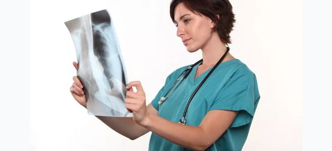 что лечит врач пульмонолог что лечит врач пульмонолог