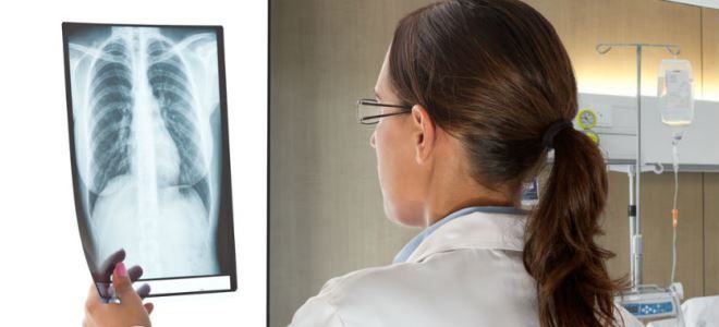 что такое рентгенография что такое рентгенография