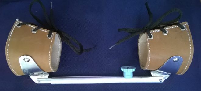 дисплазия шина виленского дисплазия шина виленского