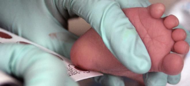 фенилкетонурия диагностика фенилкетонурия диагностика