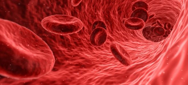 Гиперхромная анемия что это такое Гиперхромная анемия что это такое