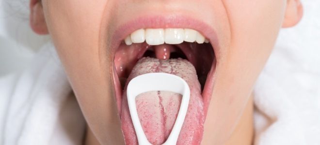 грибок кандида в горле грибок кандида в горле