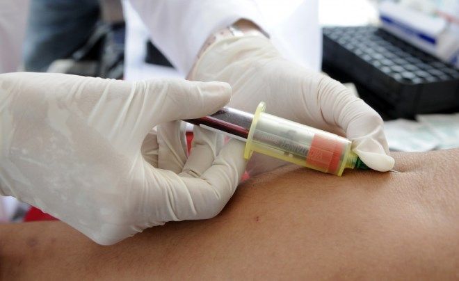 показатели биохимии крови показатели биохимии крови