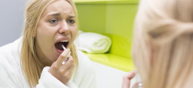 признаки тонзиллита признаки тонзиллита