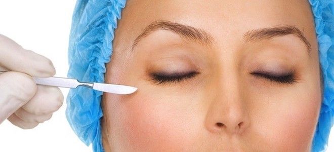 зоны липофилинга лица зоны липофилинга лица