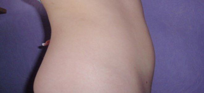 2 месяца беременности 2 месяца беременности