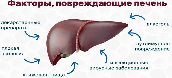 фото3 асцит при заболевании печени