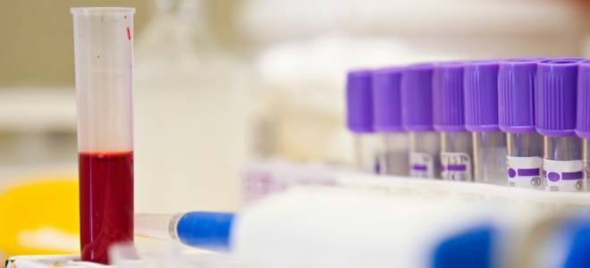 что означает биохимический анализ крови что означает биохимический анализ крови