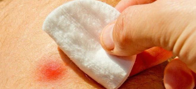 ихтиоловая мазь применение ихтиоловая мазь применение